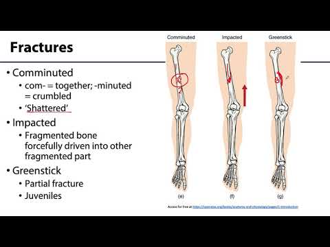 MSK Skeletal System Basics - Fractures