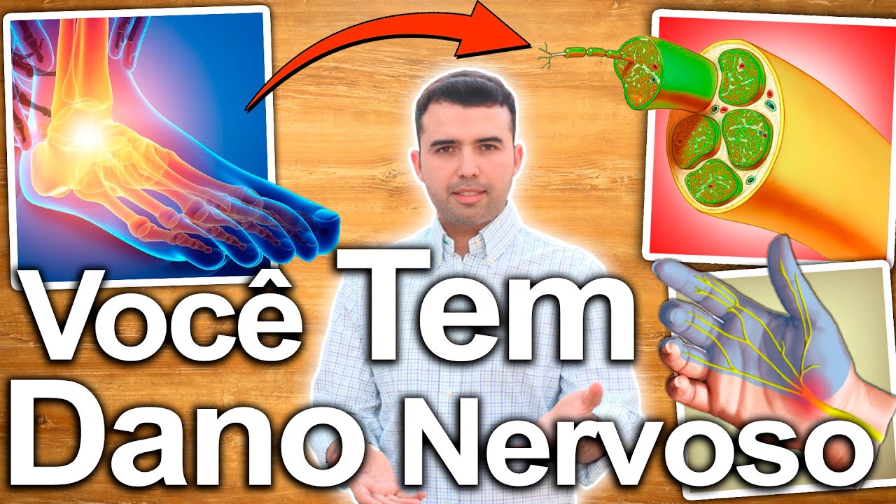 SINTOMAS DE NEUROPATIA E COMO REVERTÊ-LA - NERVOS DANIFICADOS - NÃO MAIS FORMIGAMENTO E DORES
