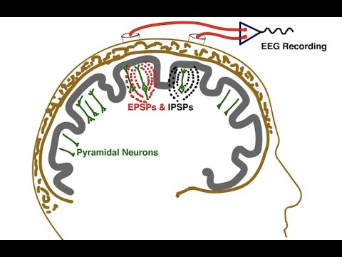 The Essential EEG Concepts you MUST master