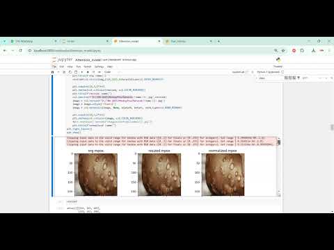 MonkeyPox Prediction System in Python Projects