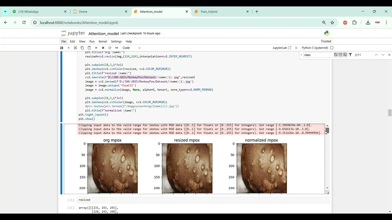 MonkeyPox Prediction System in Python Projects