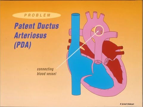 20160510 Congenital Heart Disease and Anesthesia: Foundational Concepts