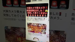 大腸カメラ胃カメラ検査結果出ました‼️覚悟してみてください‼️詳しくは本編で‼️チャンネル登録よろしく‼️2026年8月8日‼️