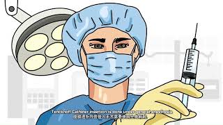 Tenckhoff Catheter Insertion