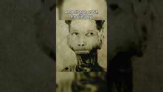 Strangest ways people have died💀 #shorts #youtubeshorts