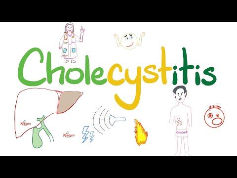 Cholecystitis - A Tale of One Stone (Cholelith) - The most COMPREHENSIVE Review