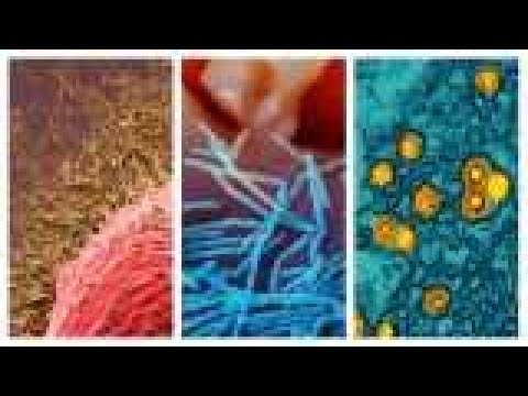 Tripledemia: cosa sapere su COVID-19, influenza e virus respiratorio sinciziale nell'area di St. ...