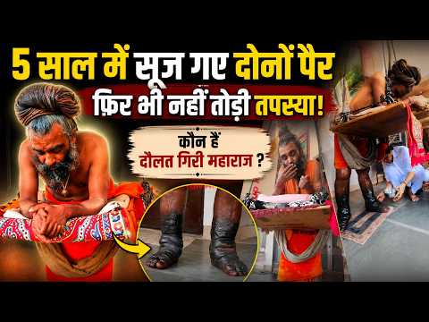 Indian Ascetic Monk Hasn’t Sat Down in Five Years, Has the Swollen Legs to Prove It