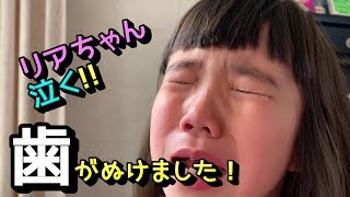 【サラリアミニ】リアちゃん歯が抜けた!! / Baby teeth fell out.