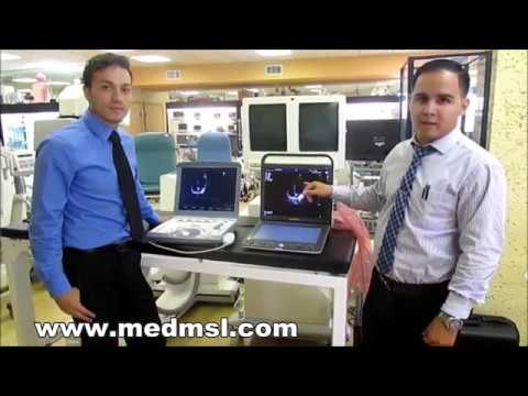 GE Vivid and Sonoscape S9 Ultrasound cardiac exam Comparison