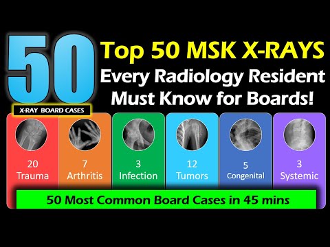 Top 50 MSK Diagnoses Every Radiology Resident Must Know! #radiology #xray #medicalstudent
