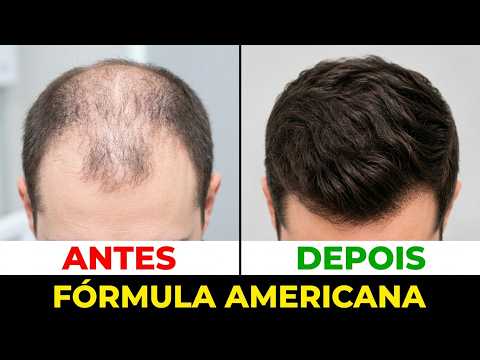 Folixil É o Suplemento Certo Pra Queda de Cabelo? O Que Dizem os TESTES