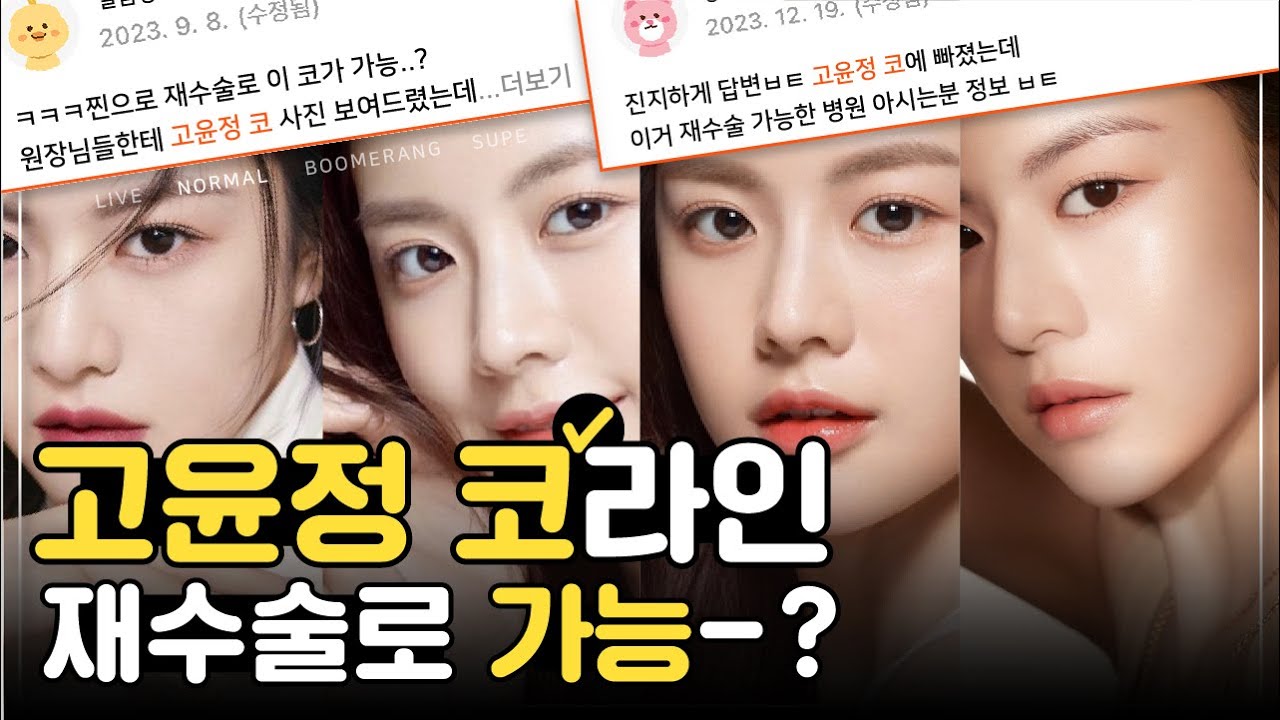 고윤정 코 재수술로<br />
가능할까요?