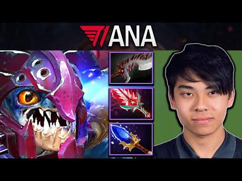 Slark Dota 2 Gameplay T1.Ana with Crazy 100 Agility and 29 Kills #dota2 #dota2gameplay