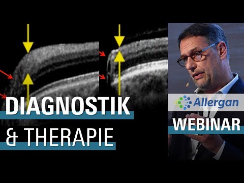 🇩🇪 Update Glaukom: Diagnostik und Therapie (Juli 2020)