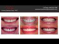 About Cosmetic Dentistry Center NYC - Top Manhattan Cosmetic Dentist - Free Consultations