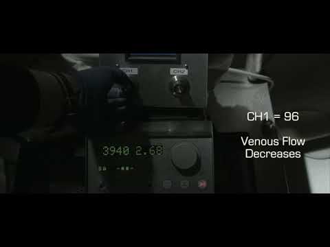 ВИДЕООБЗОР беспроводного симулятора «EIGENFLOW 2» («ЭКМО»)