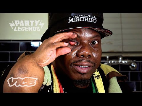 How Rapper Bushwick Bill Lost His Eye