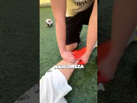 To NAJGORSZA kontuzja jaką miałem!🤮