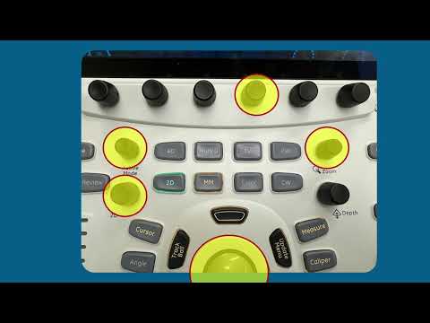 GE VividE95 3D Knobology