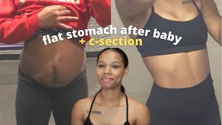 how to get a flat stomach after c section 2022