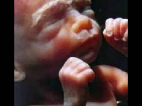 The Miracle of Birth 002