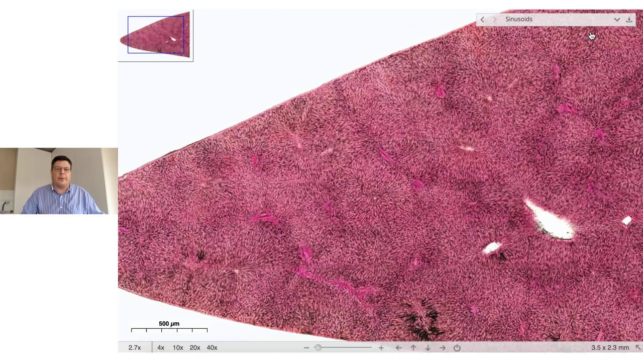 Histologia do fígado, pâncreas e vesícula biliar.