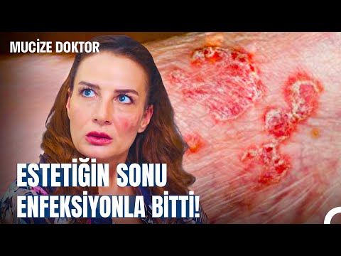 İçimdeki Canavarlar | Aşkı İçin Estetikten Vazgeçmedi! - Mucize Doktor