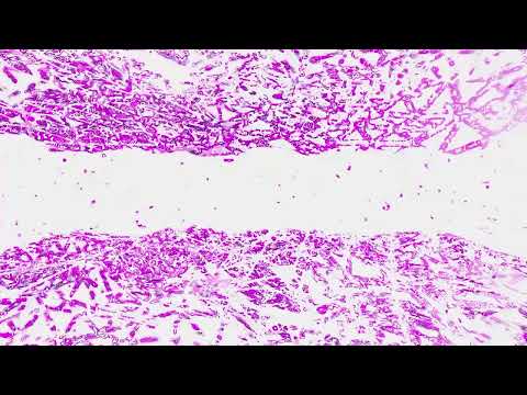 X-MARSSTON - THE (Amor Fatal Remix) [GENERATIVE VISUALISER]