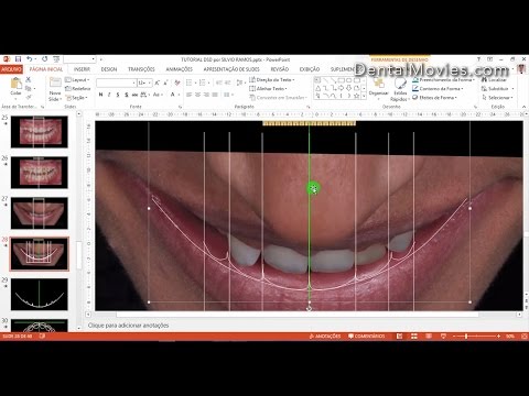 Digital Smile Design - Part 3/4. Кочман Кристиан