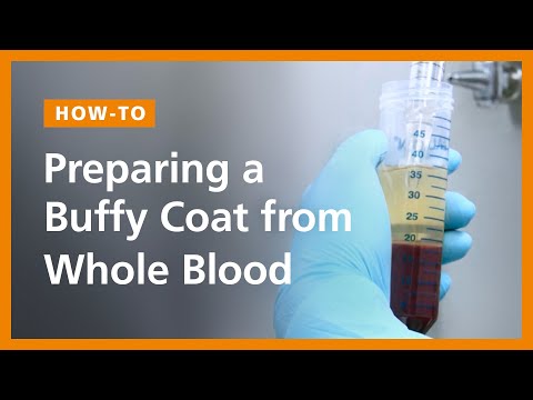 Buffy Coat