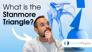 The Stanmore Triangle of Shoulder Instability | Expert Physio explains key for shoulder dislocations