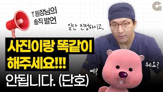 성형 상담 갈때 연예인이나 인플루언서 유튜버 사진 들고 가면 그대로 해주나요?