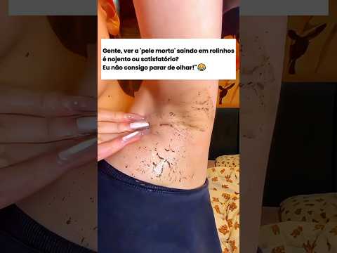 Adeus Manchas Escuras na Pele