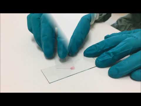 Leuco Screen Andrology