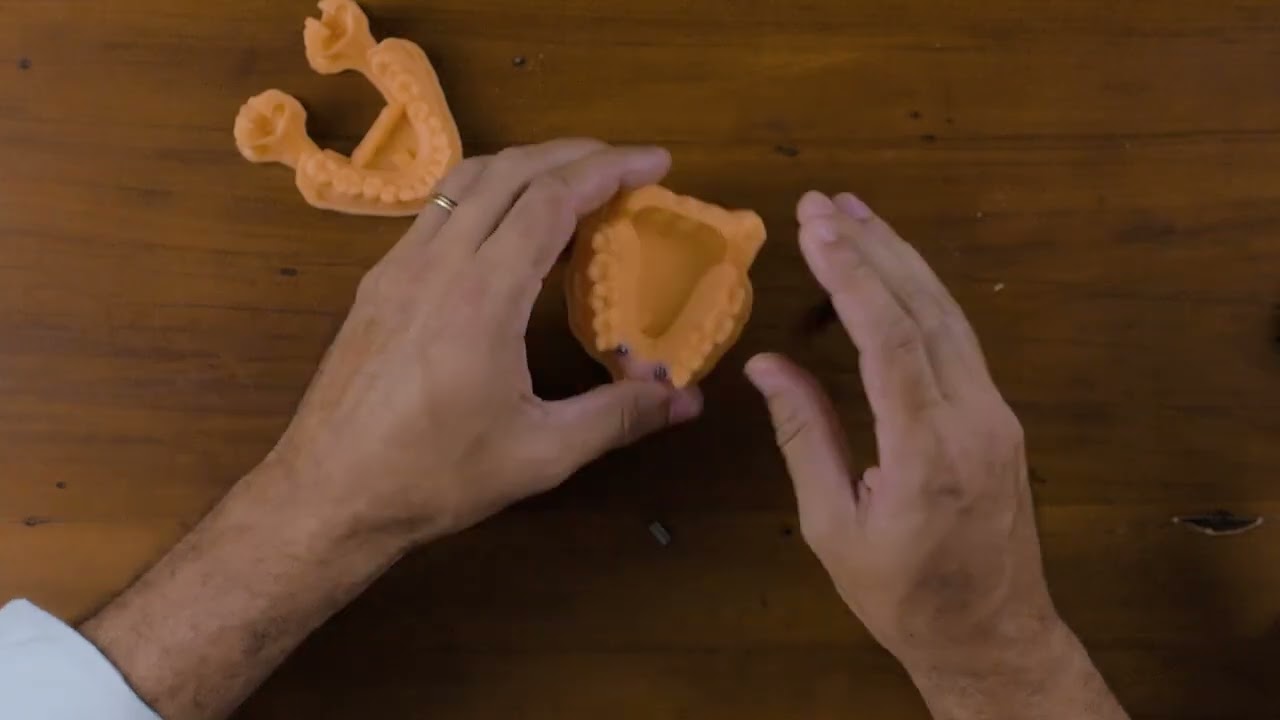 Vídeo 11 - Escaneamento para Prótese Múltipla sobre Implante