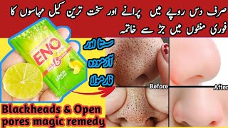 How To Remove BLACKHEADS at Home| In Just 5 Mints Best Way to Remove BLACKHEADS With Eno||Open pore|