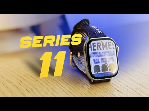 Apple Watch Series 11 / Ultra 3 and Apple Watch SE 3 Review: Which Watch Should You Buy in 2025?