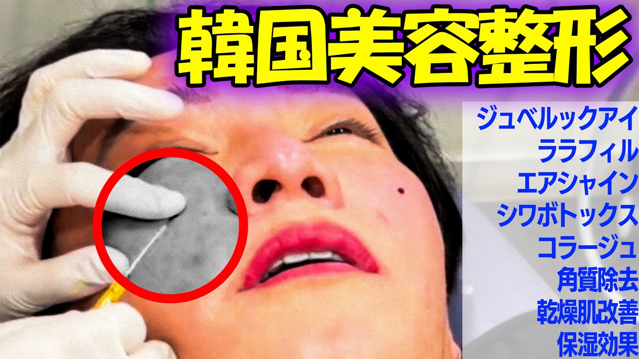 【天国と地獄】韓国で300万円が20分で消えました…整形直後の50代社長がカジノで全財産ベットした結果。睡眠麻酔で首のシワと目の下を治療したのに涙が止まらない【ソウルアイ美容外科】