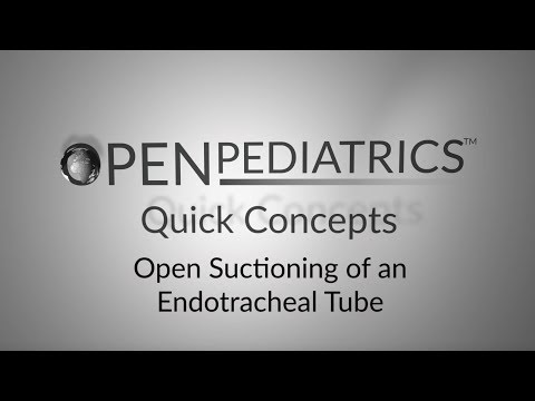 Open Suctioning of an Endotracheal Tube by M.J. Manning | OPENPediatrics