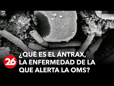 , title : '¿Qué es el ántrax, la enfermedad de la que alerta la OMS? Estos son sus síntomas'