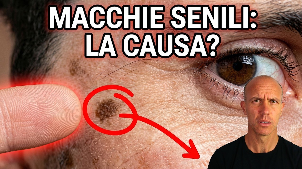 Una carenza di questo minerale provoca macchie senili💥(COME RISOLVERE)🤯