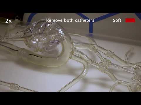 Thermoset Shape Memory Polymer Variable Stiffness 4D Robotic Catheters
