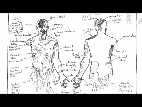 Kobe Bryant Autopsy Picture