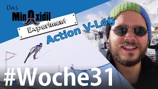 Das Minoxidil Experiment #Woche31 V-Log Action Skispringen und Fotoshooting