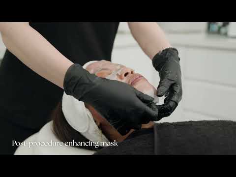 Microneedling (SkinPen) treatment at Dr Ana • The Skin Clinic