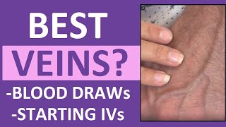 Best Veins for IV Insertion, Drawing Blood (Venipuncture Tips) in Nursing, Phlebotomy