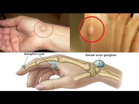 Kata-kata apa yang akan membangkitkan Wanita Cara untuk meningkatkan penis