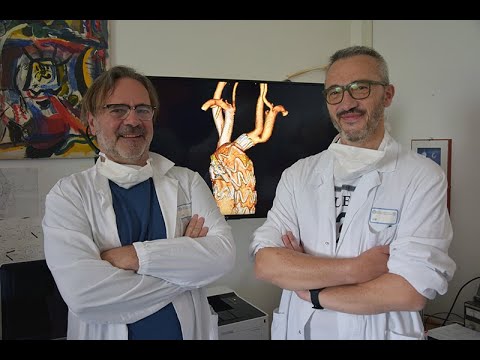 A Siena 1° caso al mondo di trattamento endovascolare dell’arco aortico con endoprotesi branched