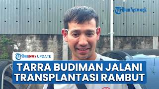 Tarra Budiman Jalani Transplantasi Rambut, Akui demi Karier dan Penampilan di Dunia Hiburan